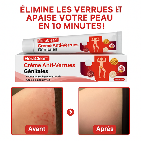 FloraClear™ Crème Anti-Verrues Génitales | Élimine les verrues et apaise votre peau en 10 minutes!