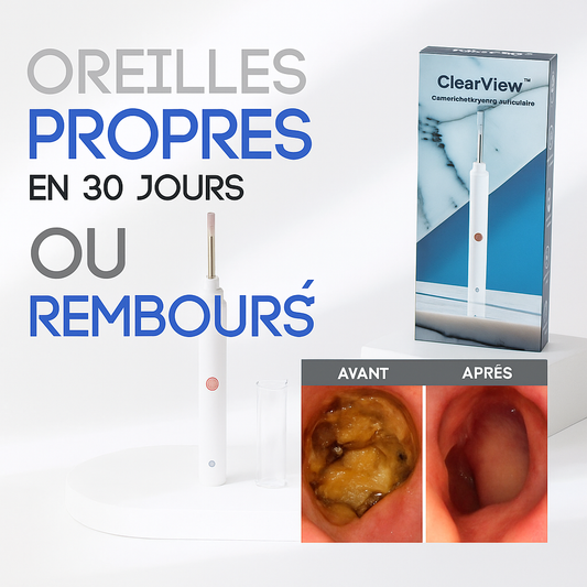 ClearView™ Caméra Nettoyante Auriculaire | Élimine le cérumen et nettoie vos oreilles en profondeur en un instant!