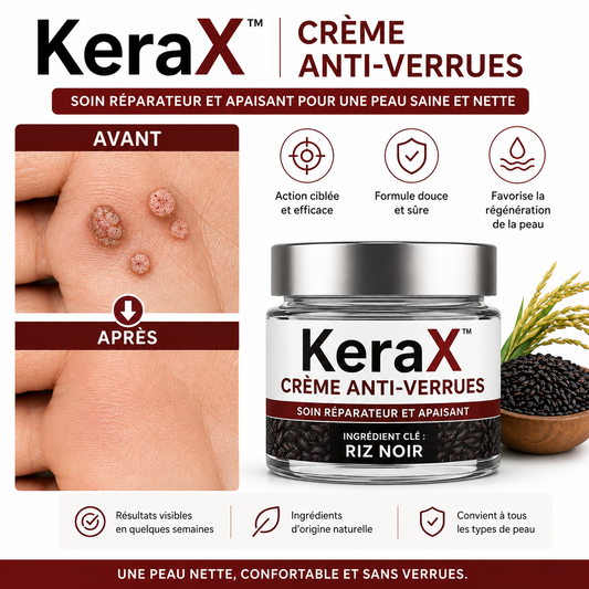 KeraX™ Crème Anti-Verrues | Élimine verrues, tumeurs cutanées et taches noires dès la 1ʳᵉ application – sans chirurgie, sans cicatrice!