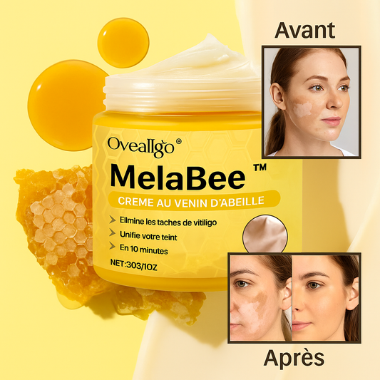 MelaBee™ Crème au Venin d’Abeille | Élimine les taches de vitiligo et unifie votre teint en 10 minutes!