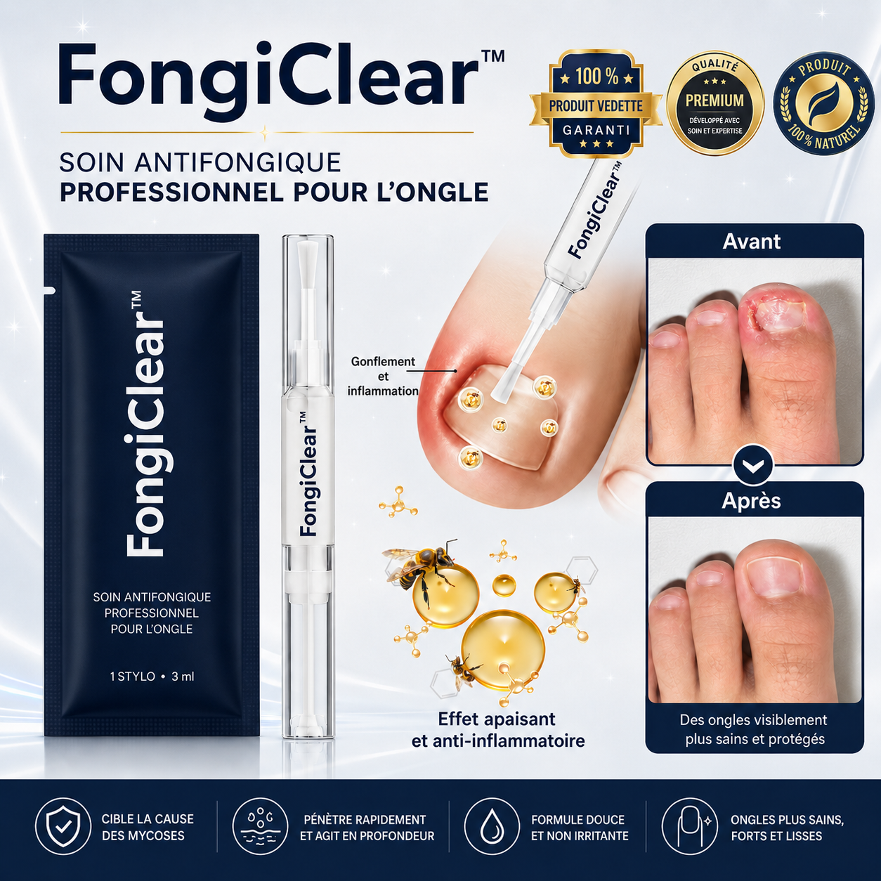 FongiClear™ Stylo Anti-Mycose des Ongles | Retrouver des ongles plus nets et plus sains dès 14 jours !