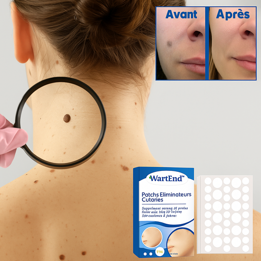 WartEnd™ Patchs Éliminateurs Cutanés | Suppriment verrues et grains de beauté jusqu’à 98 % en seulement 2 jours!