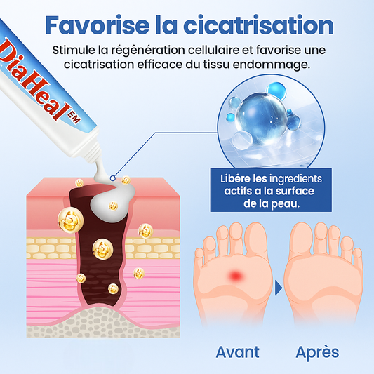 DiaHeal™ Crème Réparatrice Peau Diabétique | Accélère la cicatrisation et répare les lésions en 10 minutes!