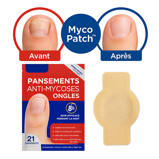 MycoPatch™ Pansements Anti-Mycoses Ongles | Éliminent les champignons et régénèrent des ongles sains en 10 minutes!