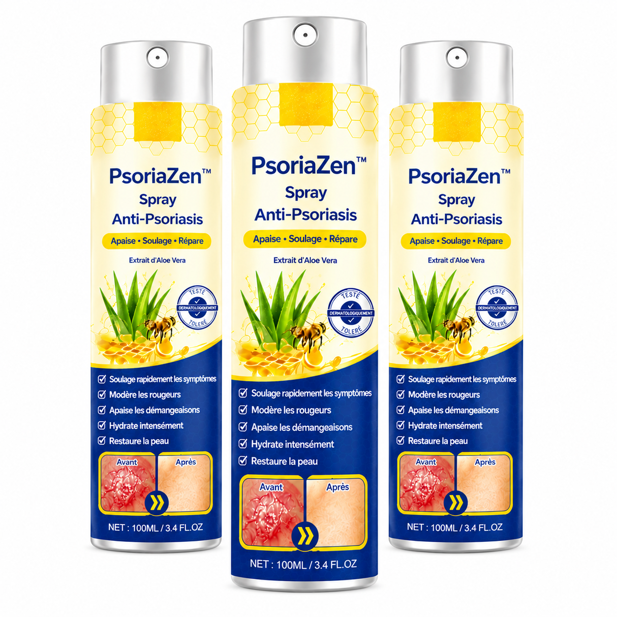 PsoriaZen™ Spray Anti-Psoriasis | Réduit jusqu’à 95 % des plaques et démangeaisons en quelques semaines !