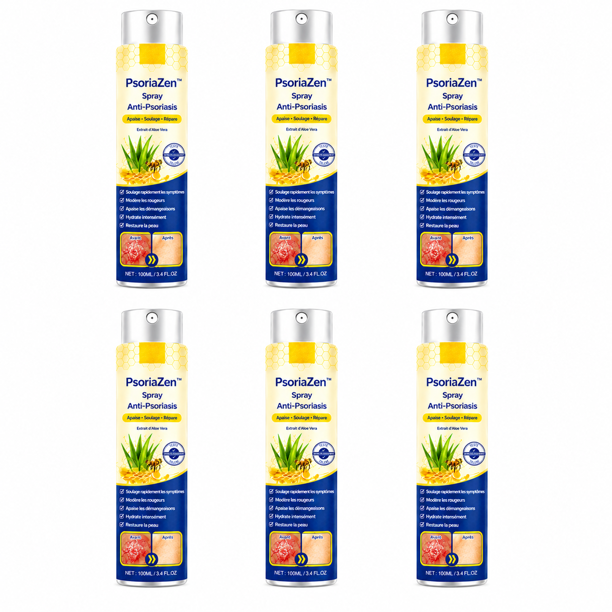 PsoriaZen™ Spray Anti-Psoriasis | Réduit jusqu’à 95 % des plaques et démangeaisons en quelques semaines !