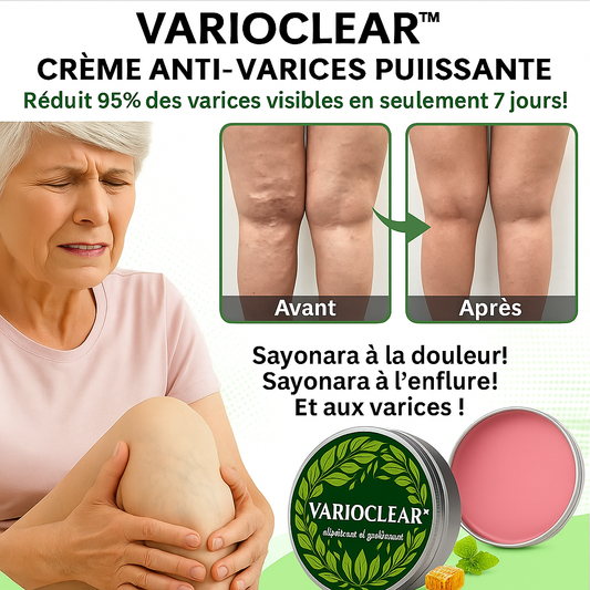 VarioClear™ Crème Anti-Varices Puissante | Réduit 95 % des varices visibles en seulement 7 jours!