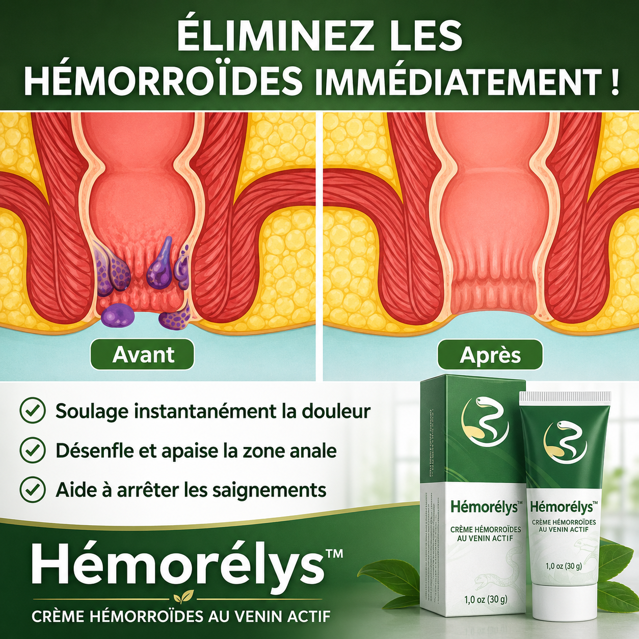 Hémorélys™ Crème Hémorroïdes au Venin Actif | Éliminez la douleur et le gonflement dès la première application !