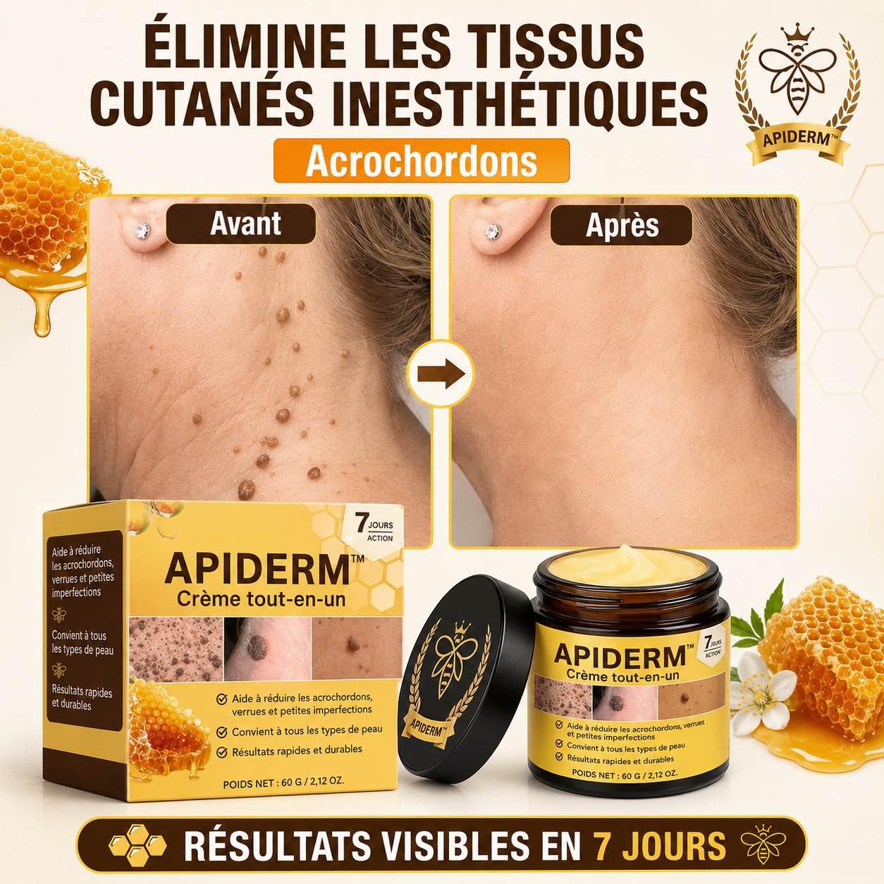 Apiderm™ Crème Cutanée au Venin d’Abeille | Soulage les irritations et régénère la peau dès les premières applications !