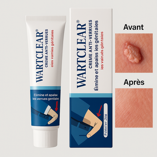 WartClear™ Crème Anti-Verrues Génitales | Élimine et apaise les verrues génitales en 10 minutes!