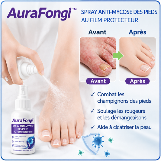AuraFongi™ Spray Pieds Anti-Mycose au Film Protecteur | Éliminez les champignons en 48h chrono !