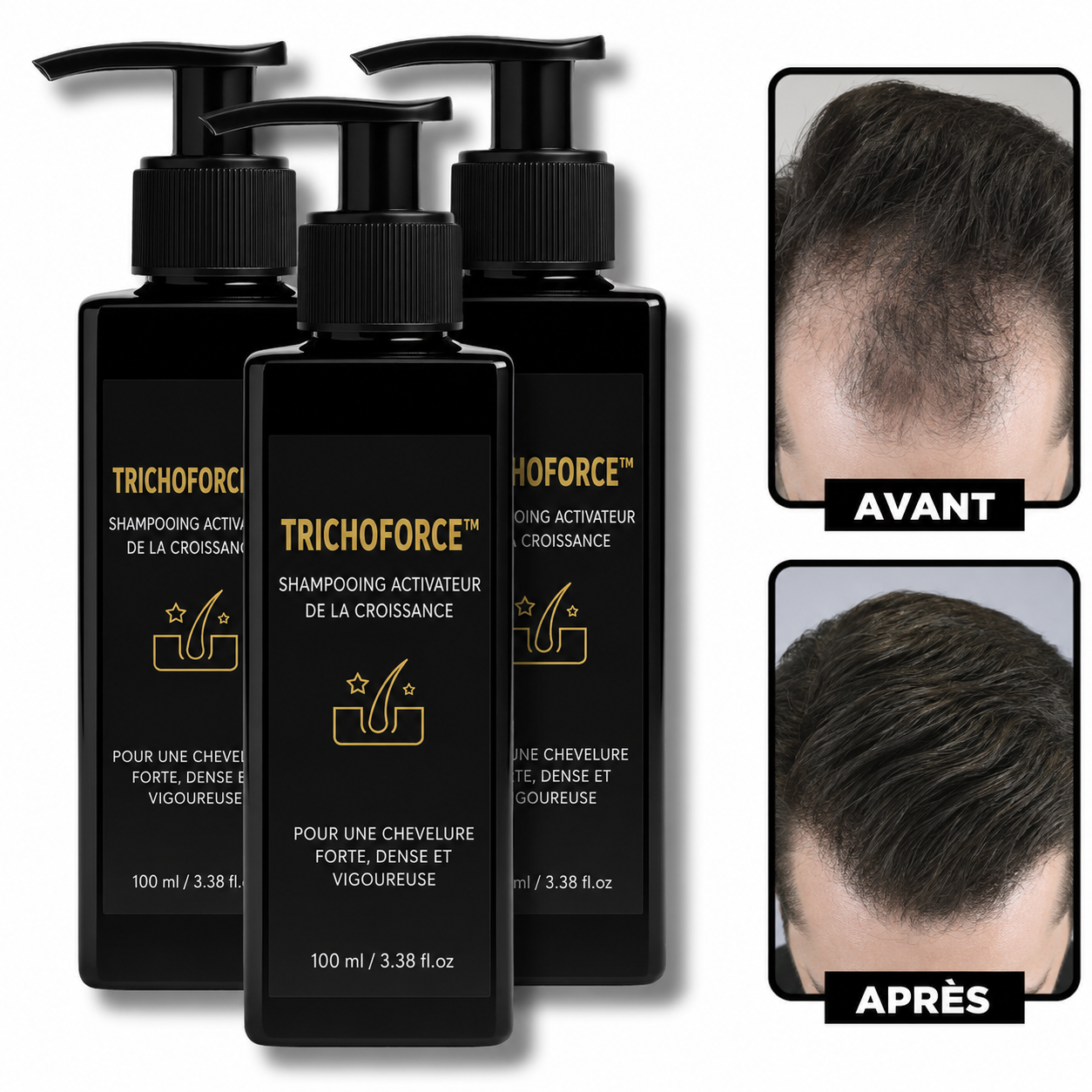 TrichoForce™ Shampooing Anti-Chute | Réactive la repousse et redonne de la densité dès les premières semaines !