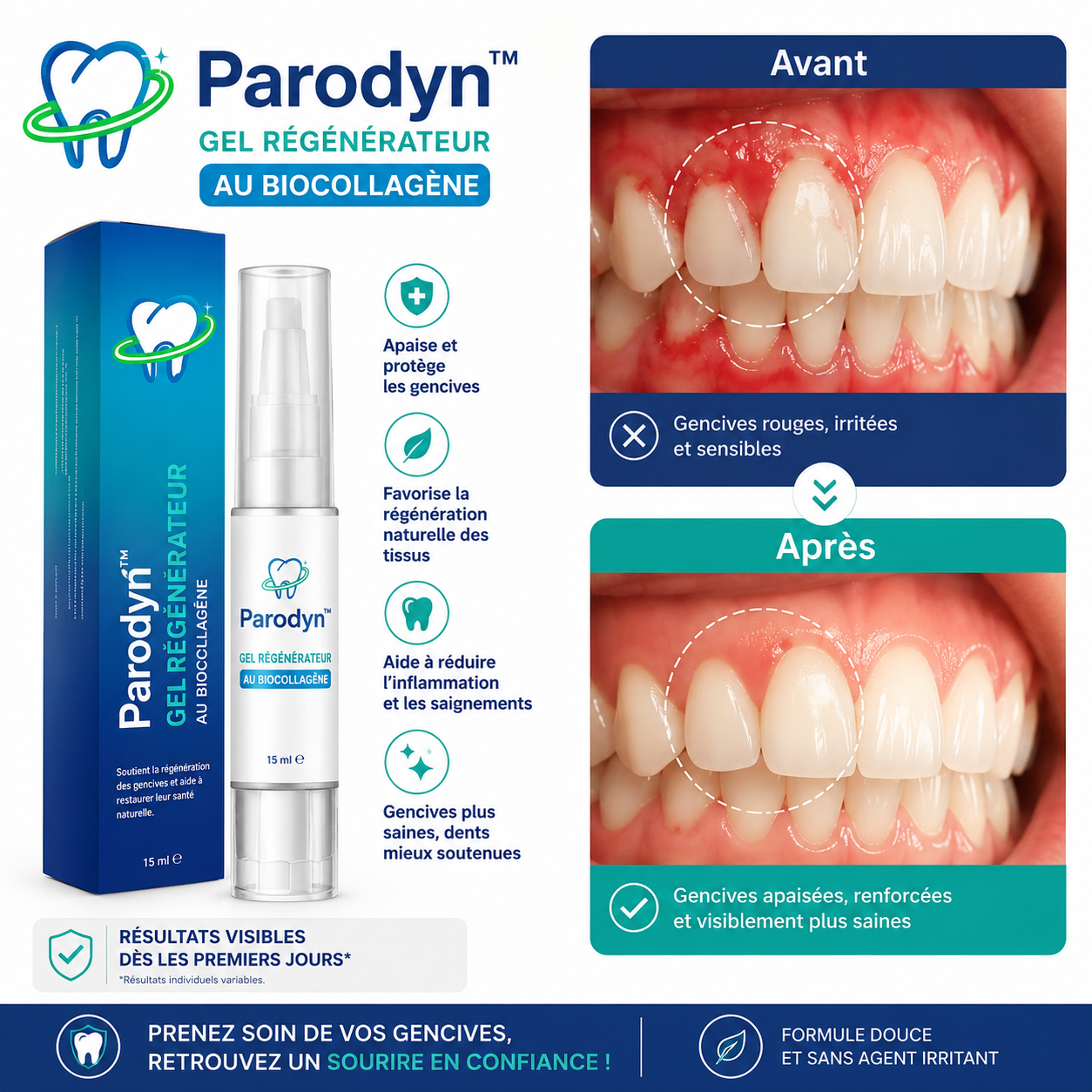 Parodyn™ Gel Régénérateur au Biocollagène | Vos gencives repoussent dès la première application!