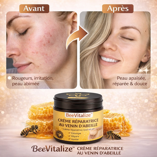 BeeVitalize™ Crème Réparatrice au Venin d’Abeille | Répare votre peau et élimine eczéma, boutons et rougeurs en quelques minutes !