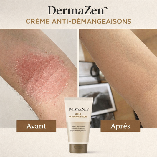 DermaZen™ Crème Anti-Démangeaisons | Éliminez les démangeaisons en 3 minutes !