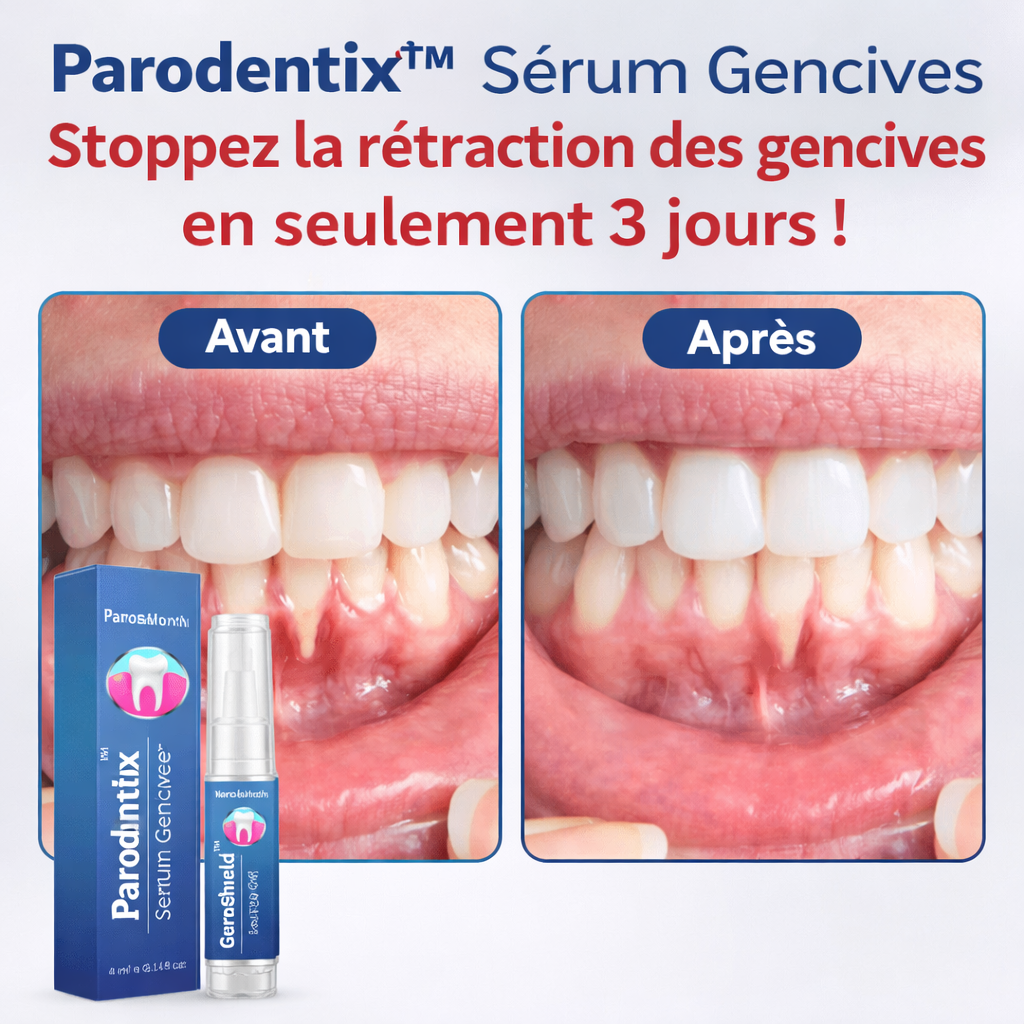Parodentix™ Sérum Gencives | Stoppez la rétraction des gencives en seulement 3 jours !
