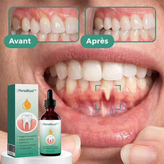 PerioBlast™ Sérum Réparateur | Stoppez la rétractation et sauvez vos dents en seulement 4 jours !