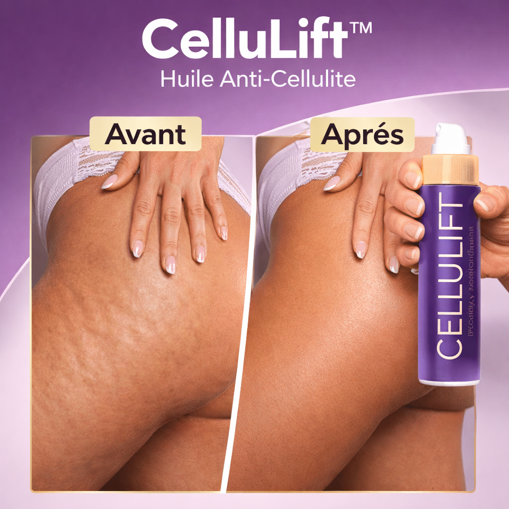 CelluLift™ Huile Anti-Cellulite | Éliminez la cellulite et raffermissez votre peau en 24 heures !