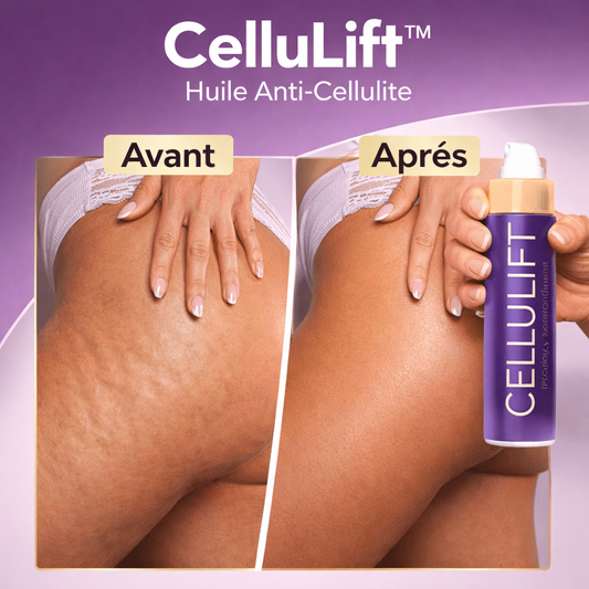 CelluLift™ Huile Anti-Cellulite | Éliminez la cellulite et raffermissez votre peau en 24 heures !