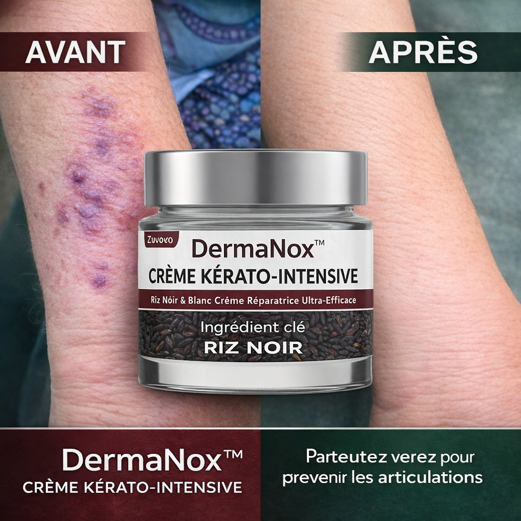 DermaNox™ Crème Kérato-Intensive | Éliminez verrues et excroissances dès la 1ʳᵉ application – sans bistouri, sans cicatrice !