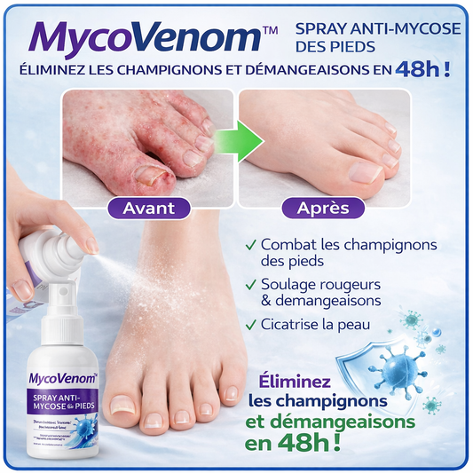 MycoVenom™ Spray Anti-Mycose des Pieds | Éliminez les champignons et démangeaisons en 48h !