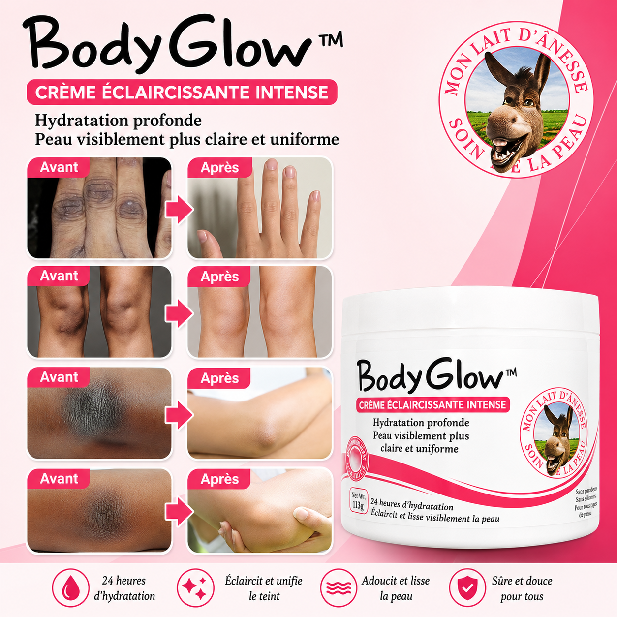 BodyGlow™ Crème Éclaircissante Corps | Supprimez les zones sombres dès 7 jours !