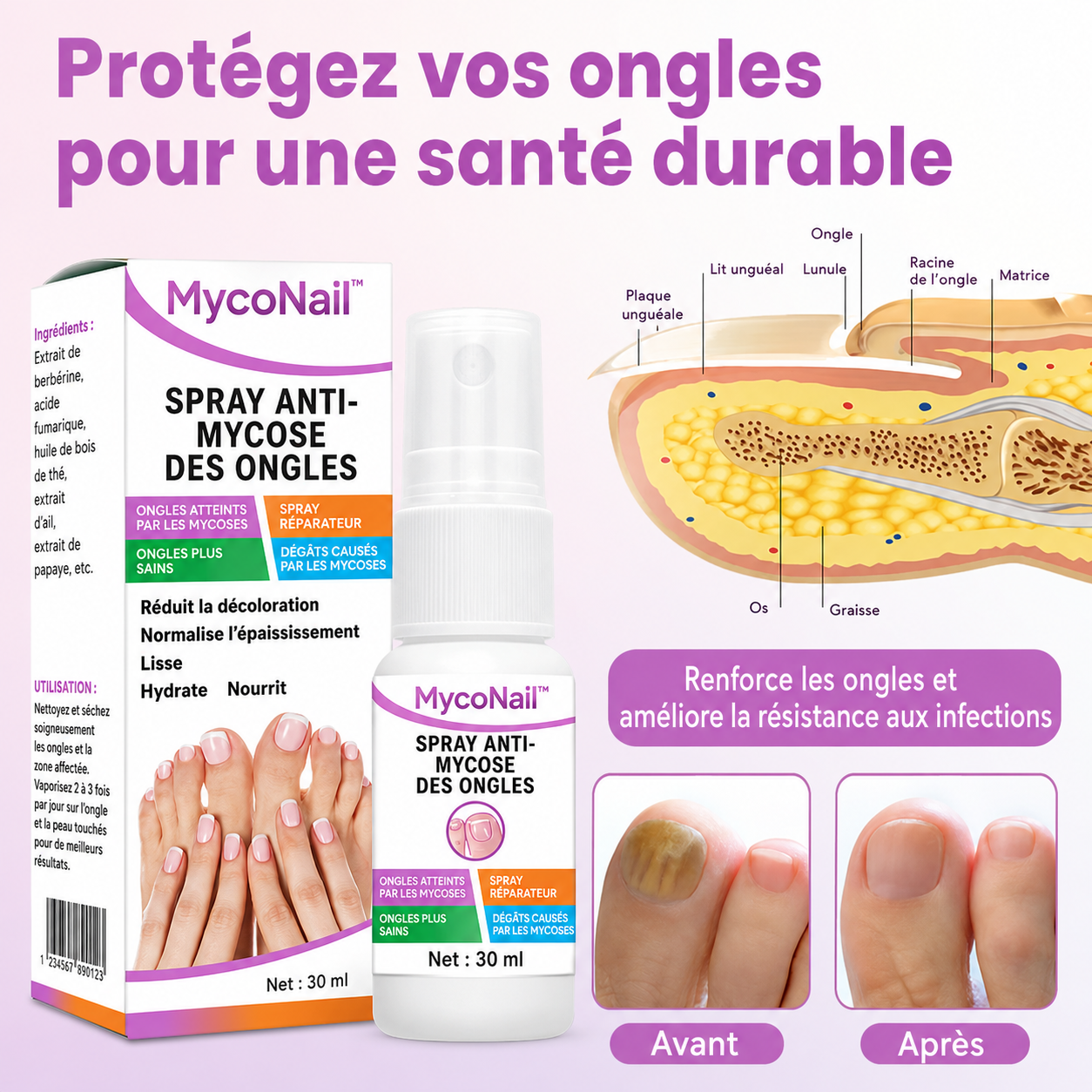 MycoNail™ Spray Anti-Mycose | Éliminez les champignons et retrouvez des ongles sains dès 7 jours !