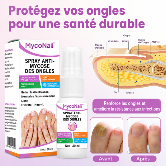 MycoNail™ Spray Anti-Mycose | Éliminez les champignons et retrouvez des ongles sains dès 7 jours !