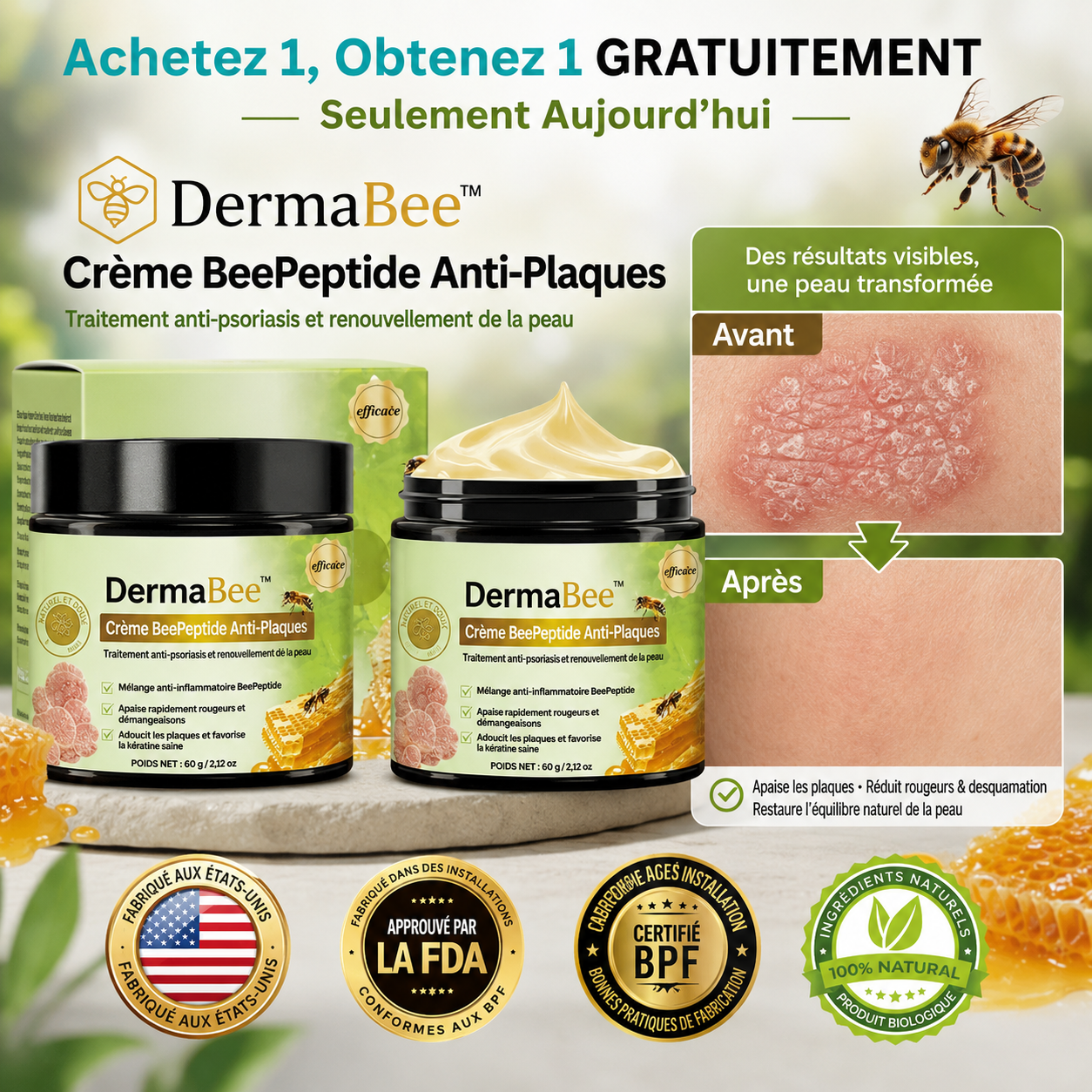 DermaBee™ Crème BeePeptide Anti-Plaques | Supprime boutons, verrues et plaques de psoriasis en 14 jours, sans brûlure ni cortisone !