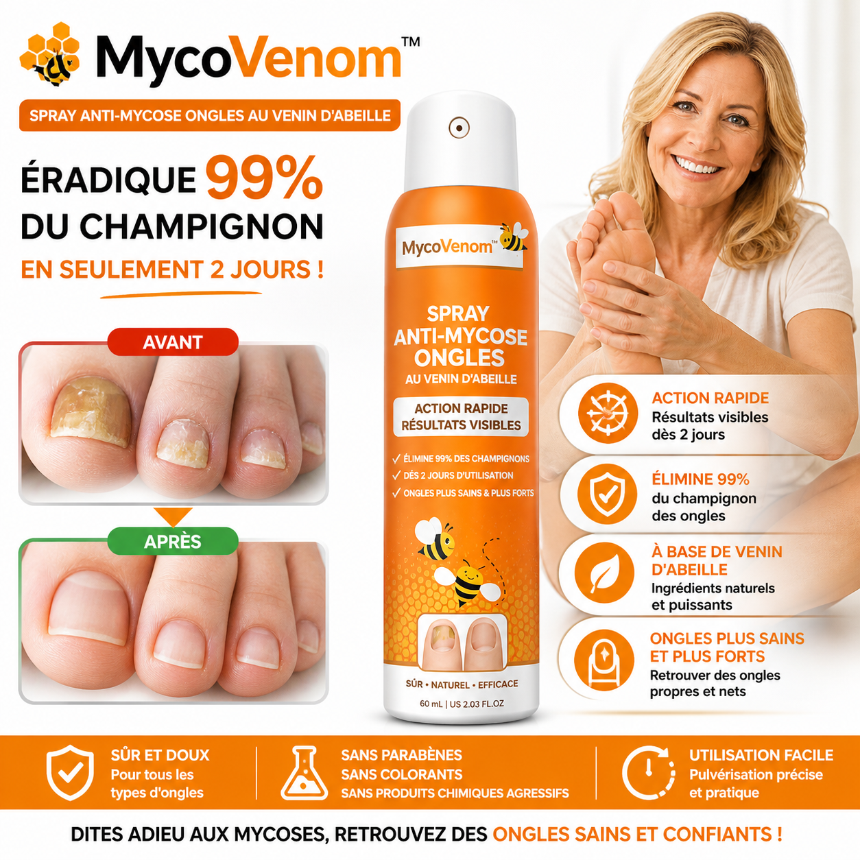 MycoVenom™ Spray Anti-Mycose Ongles au Venin d'Abeille | Éradique 99% du champignon en seulement 2 jours !