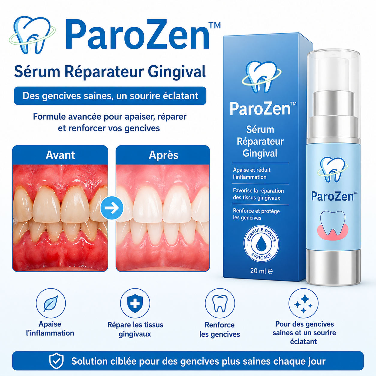 ParoZen™ Sérum Réparateur Gingival | Restaure vos gencives en seulement 3 jours!