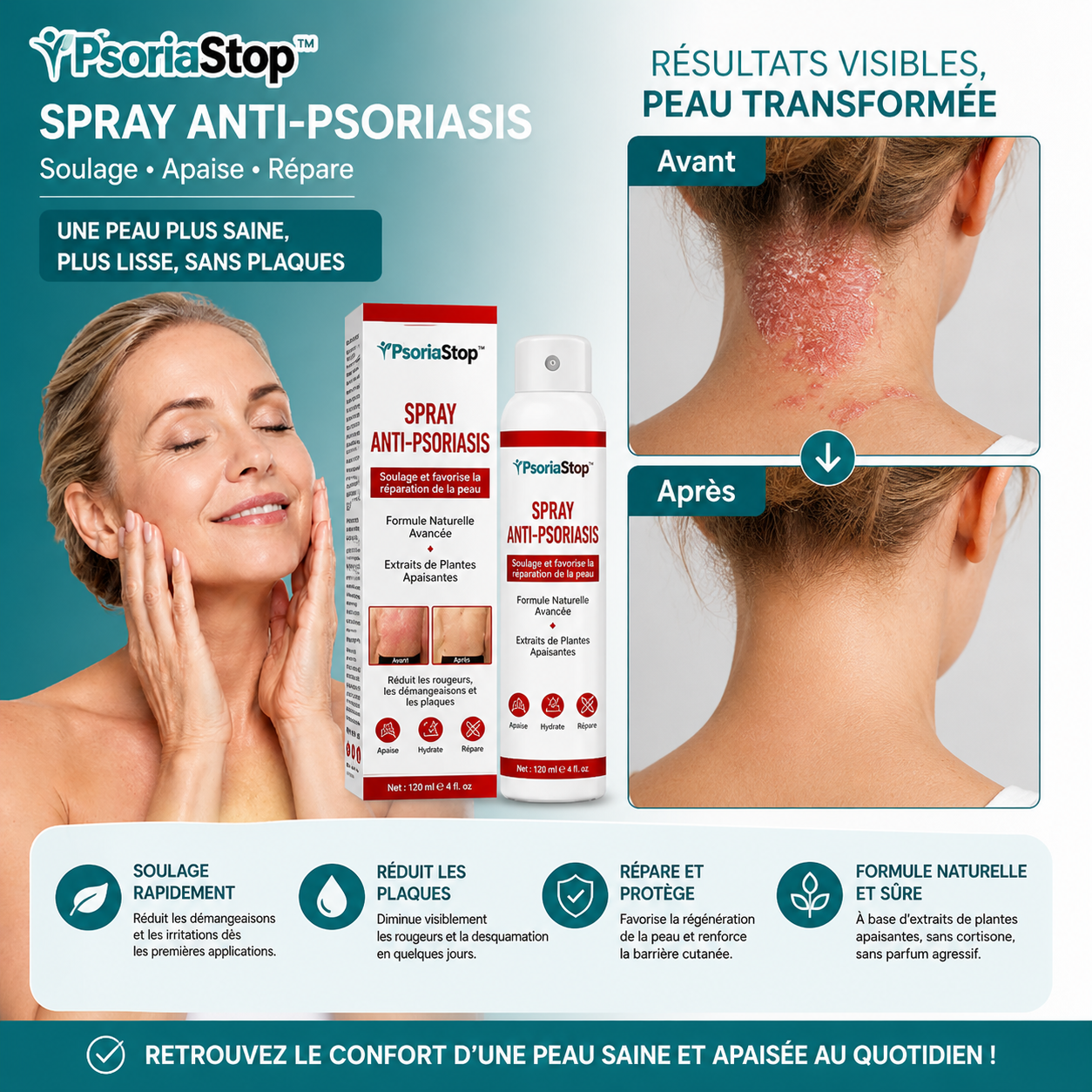 PsoriaStop™ Spray Anti-Psoriasis | Stoppe les démangeaisons et efface les plaques en 5 jours chrono !
