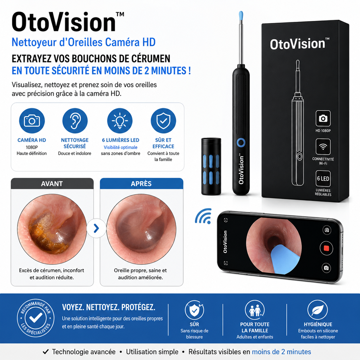 OtoVision™ Nettoyeur d'Oreilles Caméra HD | Extrayez vos bouchons de cérumen en toute sécurité en moins de 2 minutes !
