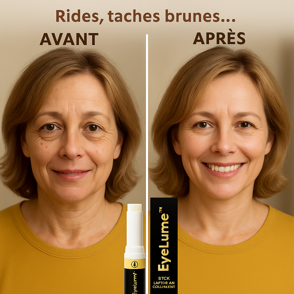EyeLume™ Stick Lissant au Collagène | Efface poches et rides sous les yeux en 24 heures!