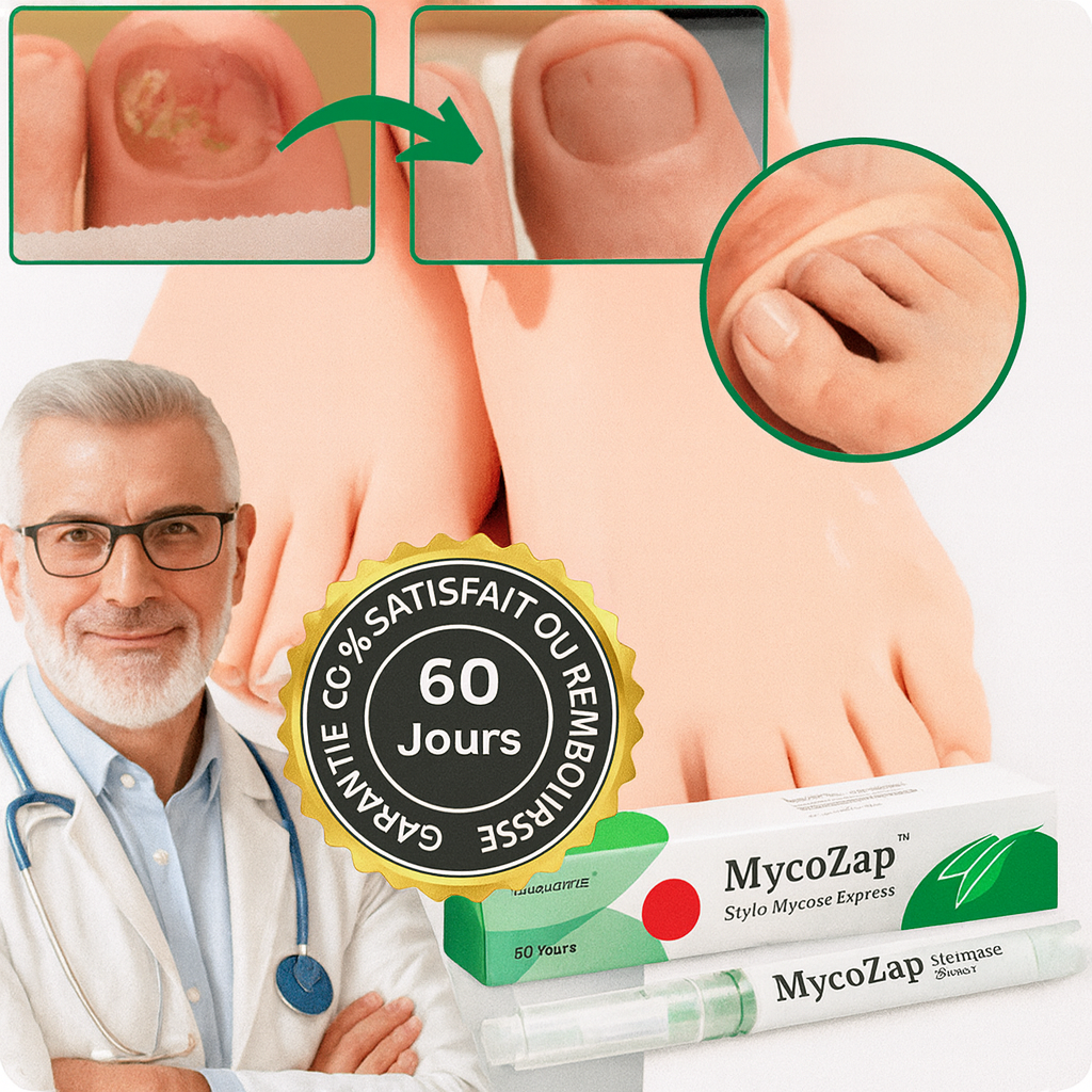 MycoZap™ Stylo Mycose Express | Détruit les champignons des ongles en 48h chrono!