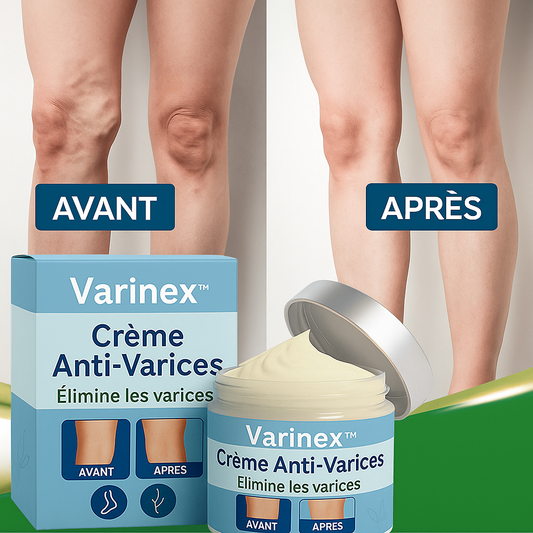 Varinex™ Crème Anti-Varices | Réduit 95 % des varices et des gonflements des jambes en seulement 7 jours!