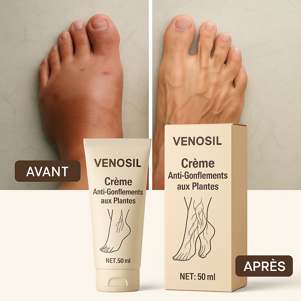VenoSil™ Crème Anti-Gonflements aux Plantes | Dites adieu au gonflement tenace en seulement 7 jours!