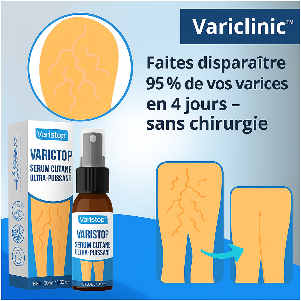 Varistop™ Sérum Cutané Ultra-Puissant | Faites disparaître 95 % de vos varices en 4 jours – sans chirurgie!