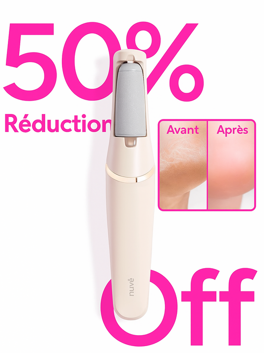 CallusXpert™ Appareil Anti-Callosité | Pieds lisses en 5 min – fini les crèmes inefficaces!
