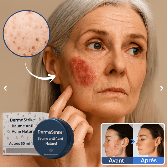 DermaStrike™ Baume Anti-Acné Naturel | Efface Boutons et Rougeurs en 4 Jours Chrono!