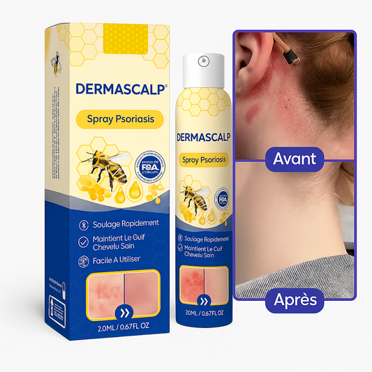 DermaScalp™ Spray Psoriasis à la Propolis Noire | Faites disparaître 95% des imperfections en 5 jours seulement!