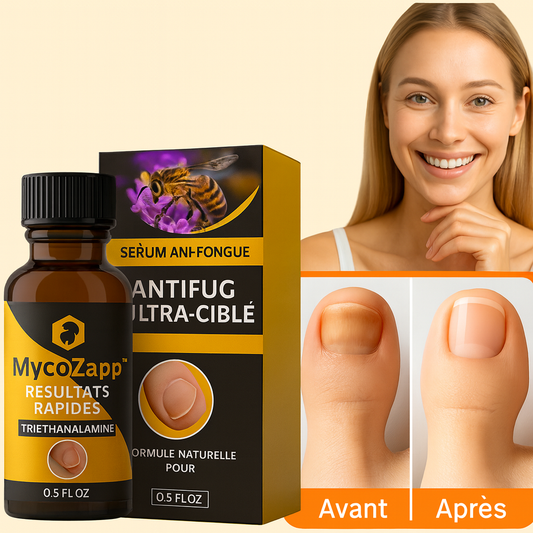 MycoZapp™ Sérum Antimycosique Ultra-Ciblé | Détruisez 100% des champignons en 3 minutes d’application!