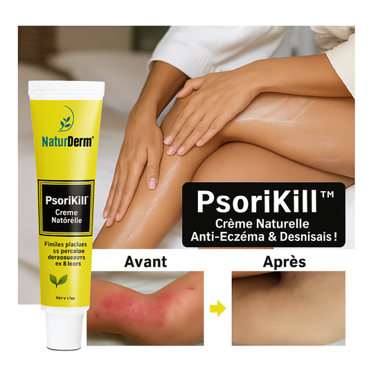 PsoriKill™ Crème Anti-Eczéma & Psoriasis | Élimine 98 % des plaques et apaise la peau en 3 jours!