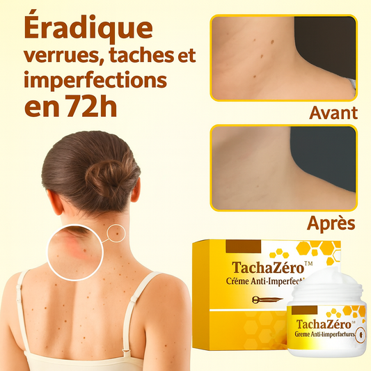 TachaZéro™ Crème Anti-Imperfections | Éradique verrues, taches et imperfections en 72h – sans scalpel ni dermatologue!