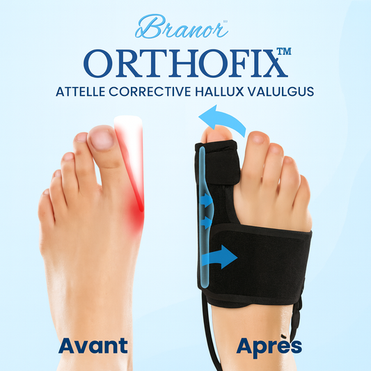 OrthoFix™ Attelle Corrective Hallux Valgus | Redresse votre oignon sans chirurgie en 20 minutes par jour!