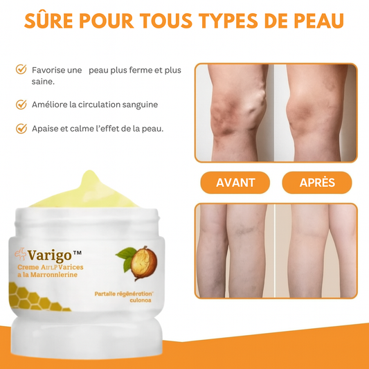 Varigo™ Crème Anti-Varices à la Marronnierine | Fait disparaître les varices dès la 1ère application!