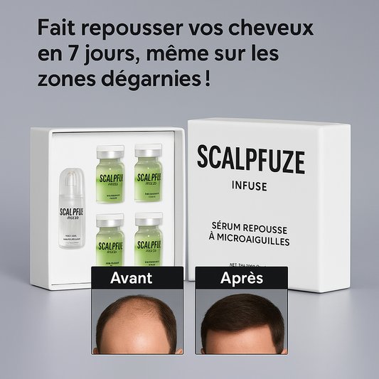 ScalpFuze™ Sérum Repousse à Microaiguilles | Fait repousser vos cheveux en 7 jours, même sur les zones dégarnies!