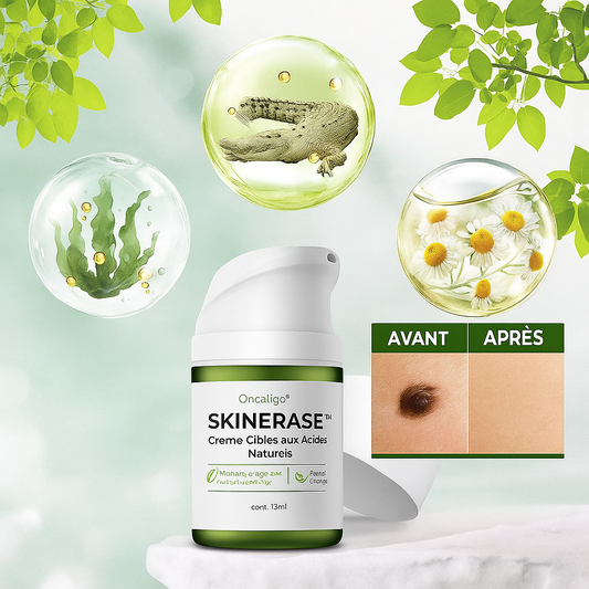 SkinErase™ Crème Ciblée aux Acides Naturels | Élimine grains de beauté et taches brunes sans trace ni cicatrice!