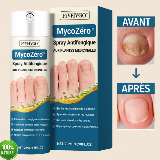 MycoZéro™ Spray Antifongique aux Plantes Médicinales | Élimine les Mycoses des Ongles en 7 Jours!