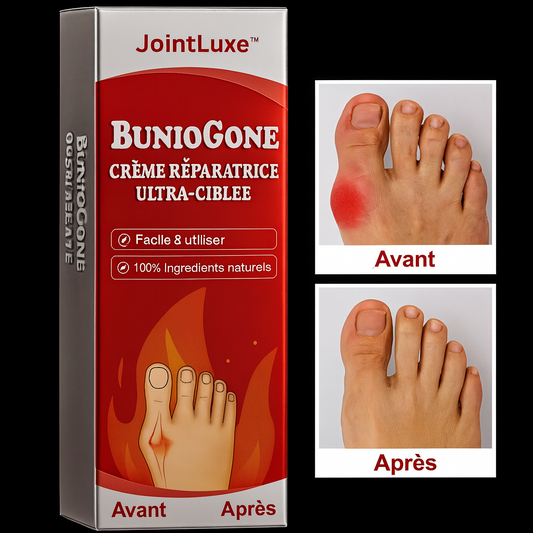 BunioGone™ Crème Réparatrice Ultra-Ciblée | Dissout les cristaux douloureux à l’origine des oignons en 7 jours!